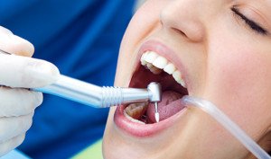 پیام معاون بهداشت وزارت بهداشت به مناسبت روز دندانپزشک